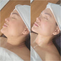 Lymphatic Reset